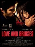 Love and Bruises